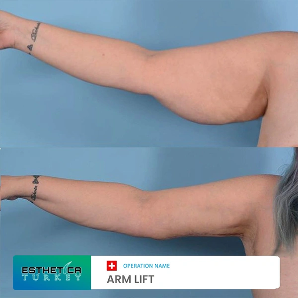 estetica plastic surgery before after (10)