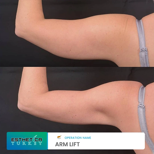 estetica plastic surgery before after (19)