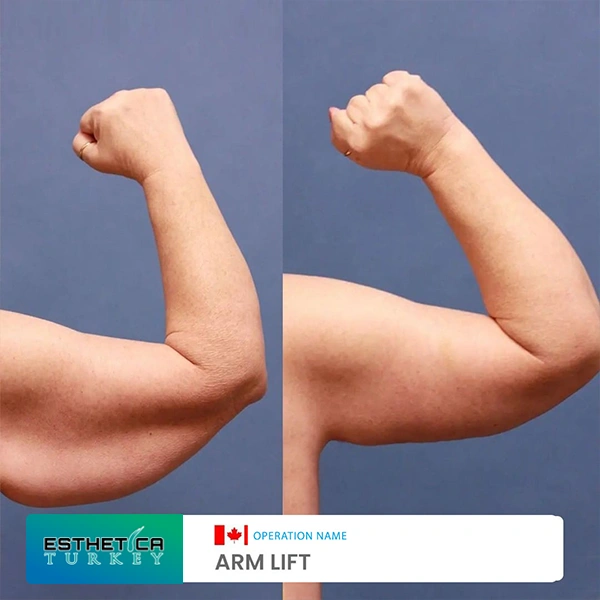 estetica plastic surgery before after (21)