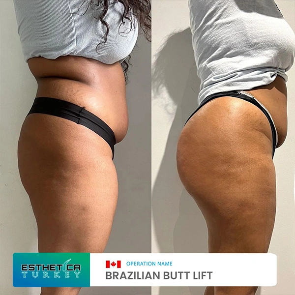 estetica plastic surgery before after (9)